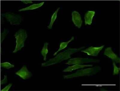 Immunocytochemistry/ Immunofluorescence: P2Y1/P2RY1 Antibody (4C2) [H00005028-M01]