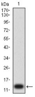 Western Blot: P2Y1/P2RY1 Antibody (4G5B7)BSA Free [NBP2-61671]