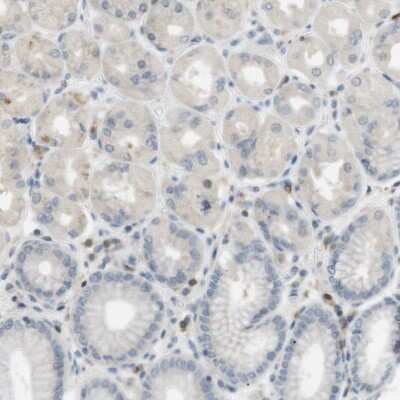 Immunohistochemistry-Paraffin: P2Y1/P2RY1 Antibody [NBP1-82439]