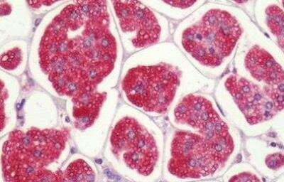 Immunohistochemistry-Paraffin: P2Y1/P2RY1 Antibody - BSA Free [NLS3795]