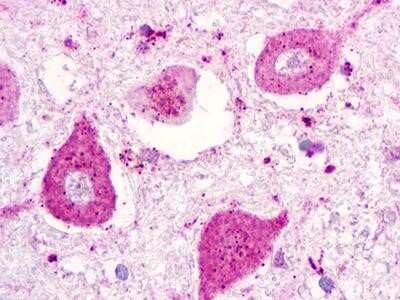 Immunohistochemistry-Paraffin: P2Y1/P2RY1 Antibody - BSA Free [NLS389]