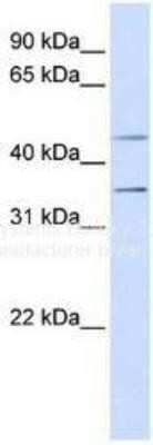 Western Blot: P2Y1/P2RY1 Antibody [NBP1-69246]