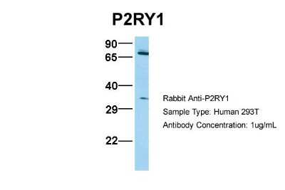 Western Blot: P2Y1/P2RY1 Antibody [NBP1-69246]