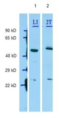 Western Blot: P2Y1/P2RY1 Antibody [NBP1-69246]