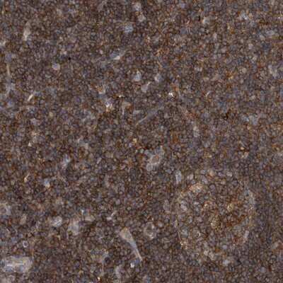 Immunohistochemistry-Paraffin: P2Y10/P2RY10 Antibody [NBP1-82438]