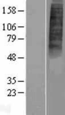 Western Blot: P2Y10/P2RY10 Overexpression Lysate [NBP2-10316]