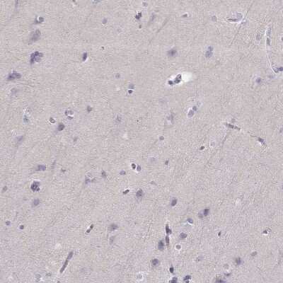 Immunohistochemistry-Paraffin: P2Y10/P2RY10 Antibody [NBP2-56283]