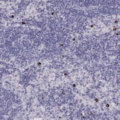 Immunohistochemistry-Paraffin: P2Y10/P2RY10 Antibody [NBP2-56283]