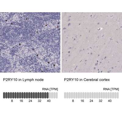 Immunohistochemistry-Paraffin: P2Y10/P2RY10 Antibody [NBP2-56283]