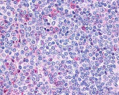 Immunohistochemistry-Paraffin: P2Y10/P2RY10 Antibody - BSA Free [NLS860]