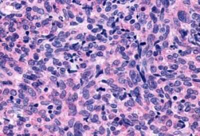 Immunohistochemistry-Paraffin: P2Y10/P2RY10 Antibody - BSA Free [NLS860]