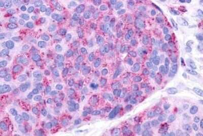 Immunohistochemistry-Paraffin: P2Y10/P2RY10 Antibody - BSA Free [NLS860]