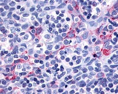 Immunohistochemistry-Paraffin: P2Y11/P2RY11 Antibody - BSA Free [NLS866]