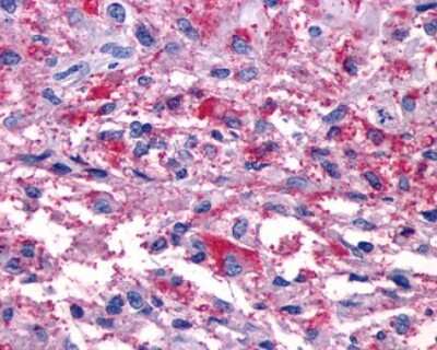 Immunohistochemistry-Paraffin: P2Y11/P2RY11 Antibody - BSA Free [NLS866]