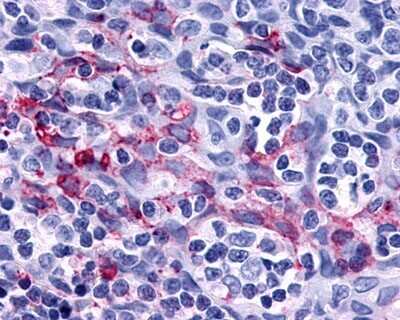 Immunohistochemistry-Paraffin: P2Y11/P2RY11 Antibody - BSA Free [NLS867]