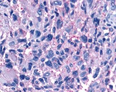 Immunohistochemistry-Paraffin: P2Y11/P2RY11 Antibody - BSA Free [NLS867]