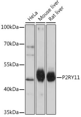 Western Blot: P2Y11/P2RY11 AntibodyAzide and BSA Free [NBP3-15501]