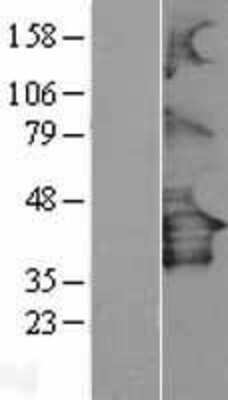 Western Blot: P2Y12/P2RY12 Overexpression Lysate [NBL1-14038]