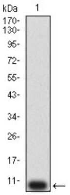 Western Blot: P2Y12/P2RY12 Antibody (1C2A9)BSA Free [NBP2-61749]