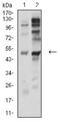 Western Blot: P2Y12/P2RY12 Antibody (1C2A9)BSA Free [NBP2-61749]