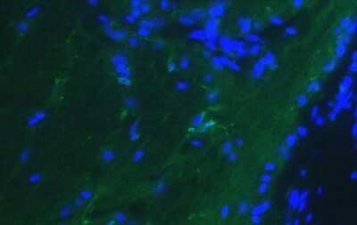Immunocytochemistry/ Immunofluorescence: P2Y12/P2RY12 Antibody [NBP2-33870]