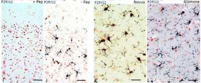 Immunohistochemistry: P2Y12/P2RY12 Antibody [NBP2-33870]
