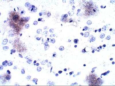 Immunohistochemistry-Paraffin: P2Y12/P2RY12 Antibody [NBP1-78249]