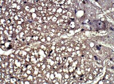 Immunohistochemistry-Paraffin: P2Y12/P2RY12 Antibody [NBP1-78249]