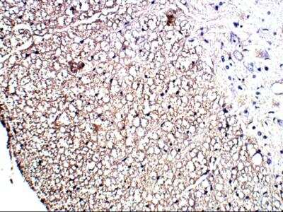 Immunohistochemistry-Paraffin: P2Y12/P2RY12 Antibody [NBP1-78249]