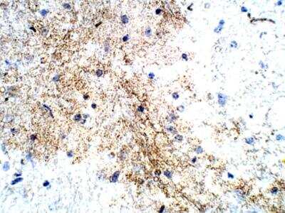 Immunohistochemistry-Paraffin: P2Y12/P2RY12 Antibody [NBP1-78249]