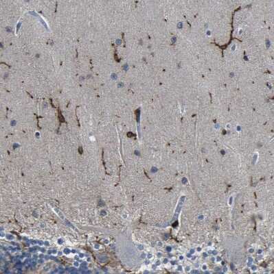 Immunohistochemistry-Paraffin: P2Y12/P2RY12 Antibody [NBP1-89673]