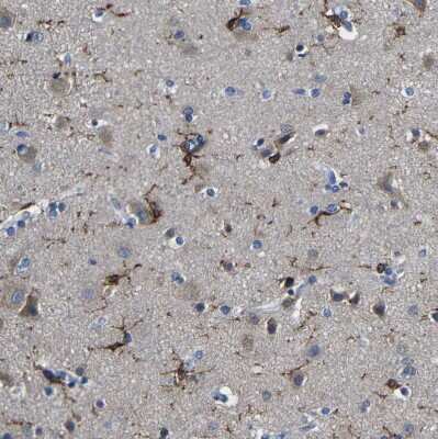 Immunohistochemistry-Paraffin: P2Y12/P2RY12 Antibody [NBP1-89673]