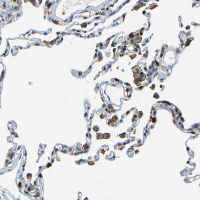Immunohistochemistry-Paraffin: P2Y12/P2RY12 Antibody [NBP1-89673]
