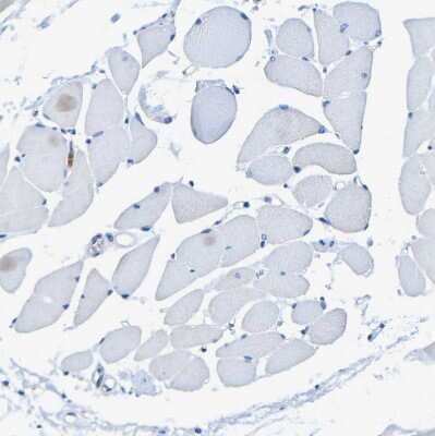 Immunohistochemistry-Paraffin: P2Y12/P2RY12 Antibody [NBP1-89673]