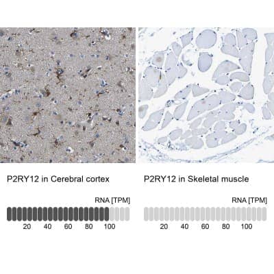 Immunohistochemistry-Paraffin: P2Y12/P2RY12 Antibody [NBP1-89673]