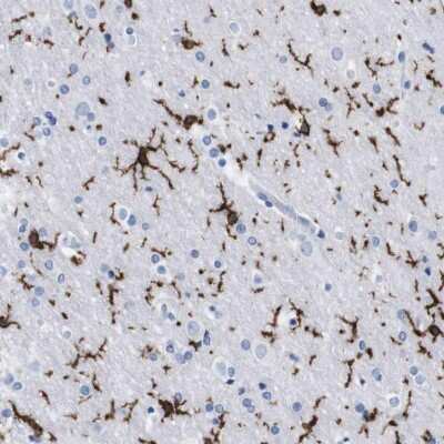 Immunohistochemistry-Paraffin: P2Y12/P2RY12 Antibody [NBP2-33870]