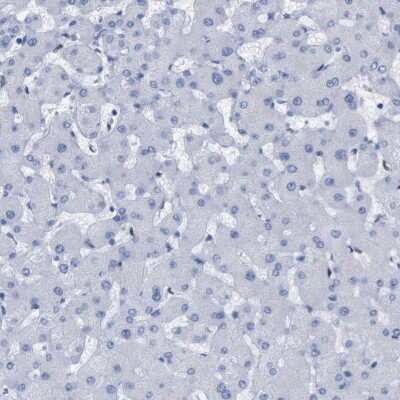 Immunohistochemistry-Paraffin: P2Y12/P2RY12 Antibody [NBP2-33870]