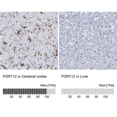 Immunohistochemistry-Paraffin: P2Y12/P2RY12 Antibody [NBP2-33870]