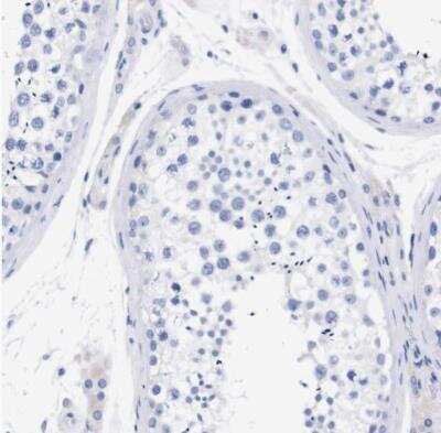 Immunohistochemistry-Paraffin: P2Y12/P2RY12 Antibody [NBP2-33870]