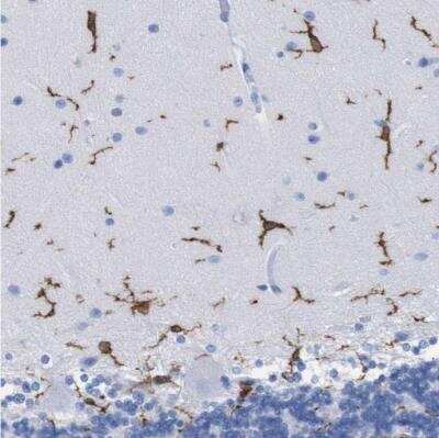 Immunohistochemistry-Paraffin: P2Y12/P2RY12 Antibody [NBP2-33870]