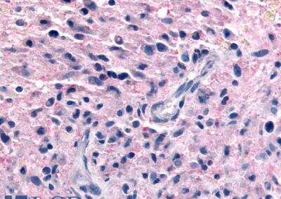 Immunohistochemistry-Paraffin: P2Y12/P2RY12 Antibody - BSA Free [NLS3742]