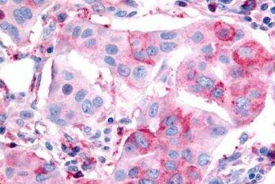 Immunohistochemistry-Paraffin: P2Y12/P2RY12 Antibody - BSA Free [NLS3742]