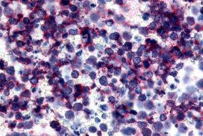 Immunohistochemistry-Paraffin: P2Y12/P2RY12 Antibody - BSA Free [NLS3742]