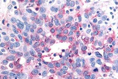 Immunohistochemistry-Paraffin: P2Y12/P2RY12 Antibody - BSA Free [NLS3742]