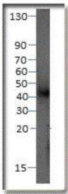 Western Blot: P2Y12/P2RY12 Antibody [NBP1-78249]