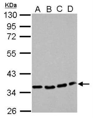 Western Blot: P2Y12/P2RY12 Antibody [NBP2-19660]