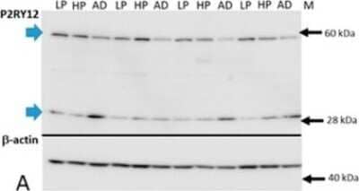 Western Blot: P2Y12/P2RY12 Antibody [NBP2-33870]