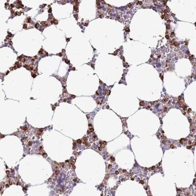 Immunohistochemistry-Paraffin: P2Y13/P2RY13/GPR86 Antibody [NBP2-13721]