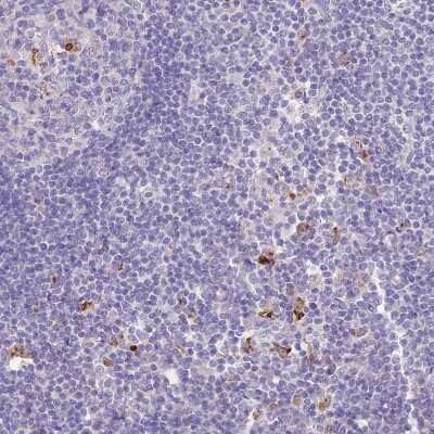 Immunohistochemistry-Paraffin: P2Y13/P2RY13/GPR86 Antibody [NBP2-13721]