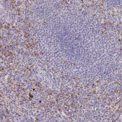 Immunohistochemistry-Paraffin: P2Y13/P2RY13/GPR86 Antibody [NBP2-13721]
